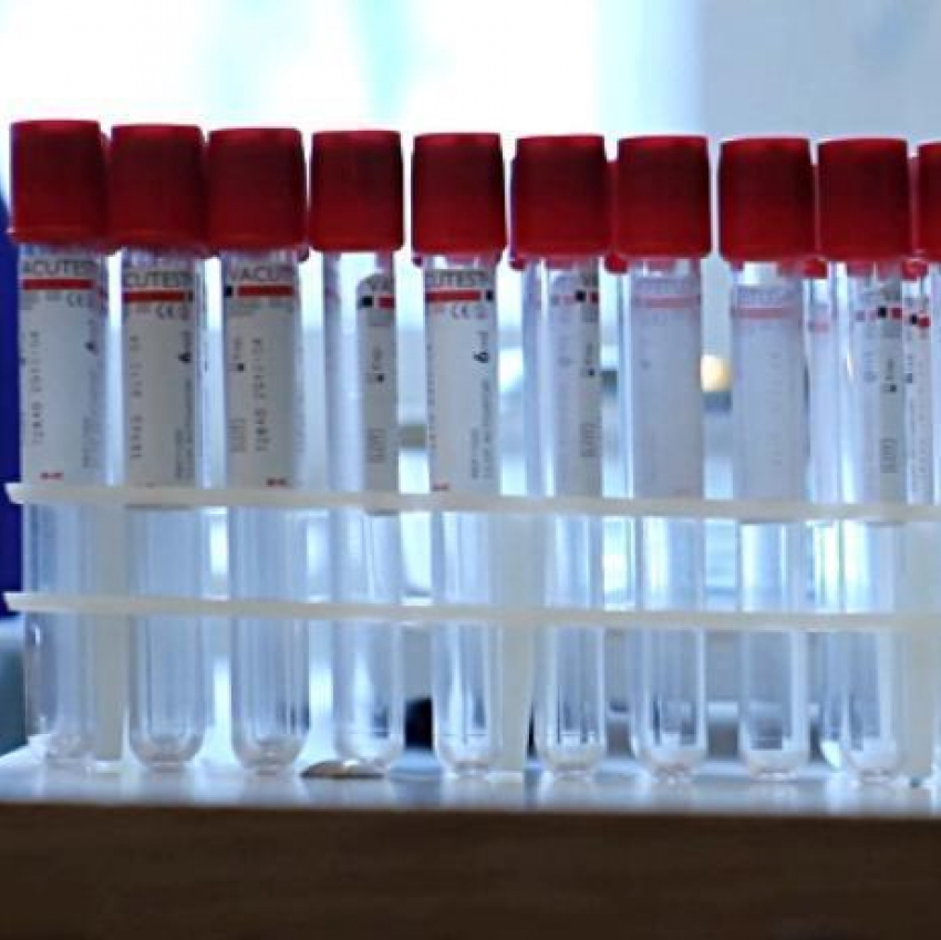 В регионе замечена тенденция снижения заболеваемости ВИЧ