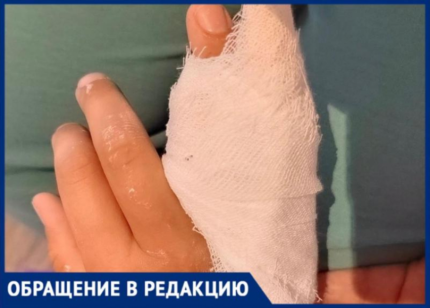 Ребенок сломал руку в летнем лагере на базе батутного городка в Волжском