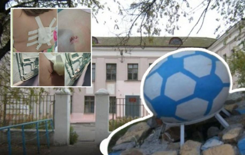 Девочка вспорола кожу о штык батареи: в школе Волжского провели расследование