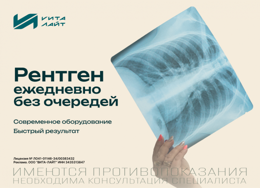 Забота о здоровье начинается с точной диагностики: рентген‑кабинет «Вита‑Лайт»