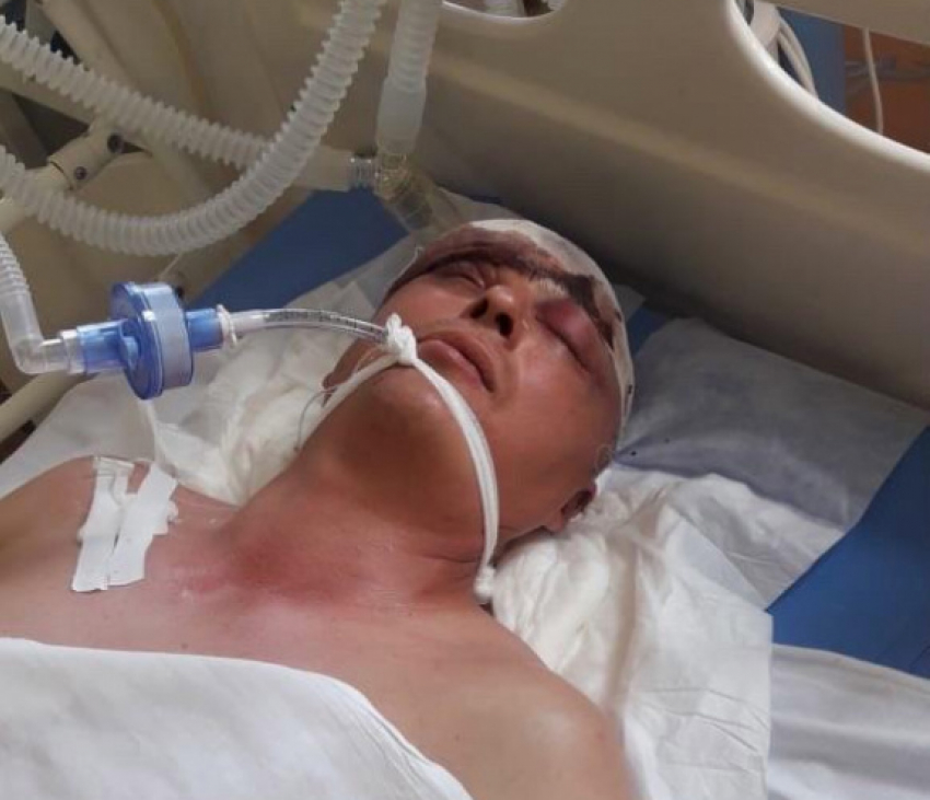 Раздроблен череп: врачи борются за жизнь 47-летнего отца двух детей в Волжском