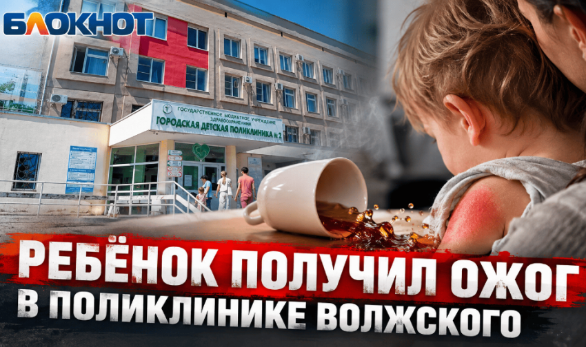 «Ребёнок забежал за спину врача»: облздрав прокомментировал ожог малыша в поликлинике Волжского
